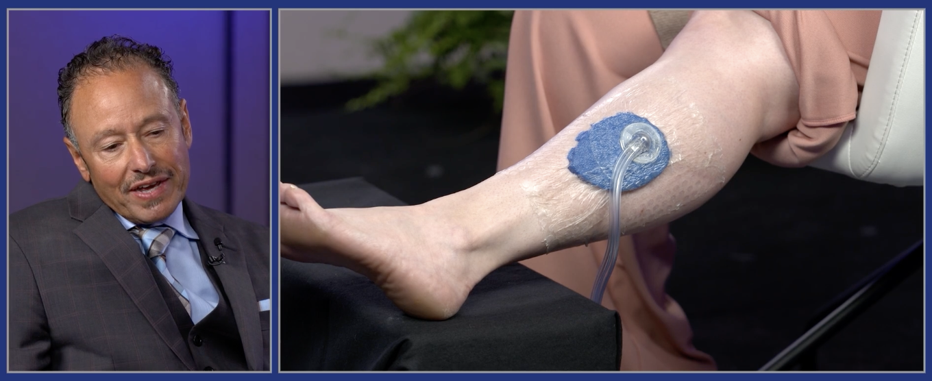 Negative Pressure Wound Therapy with Installation and Dwell