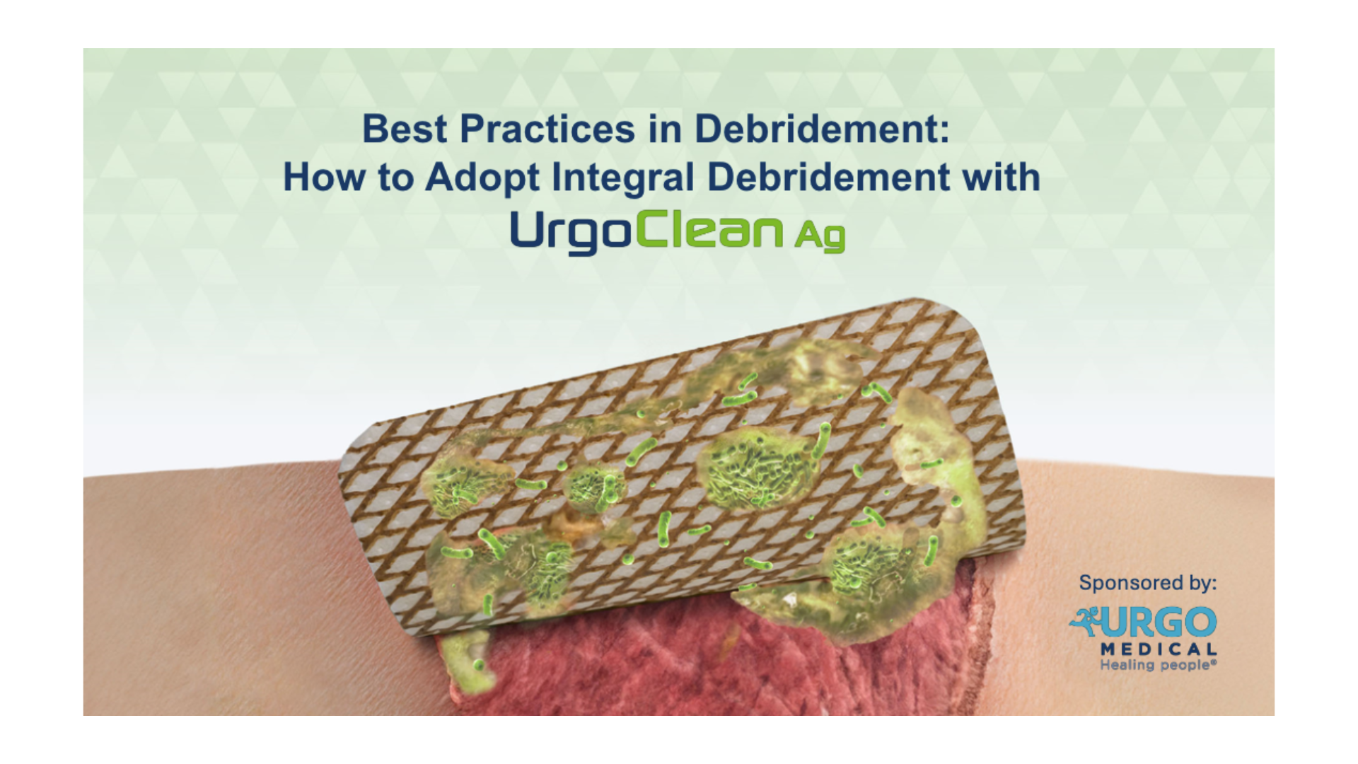 Best Practices in Debridement: How to Adopt Integral Debridement with UrgoClean Ag