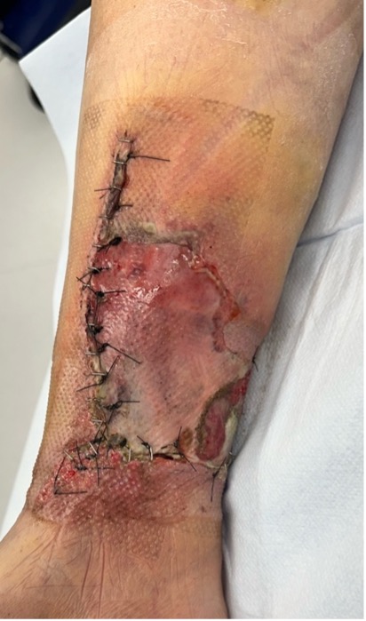 Initial examination.