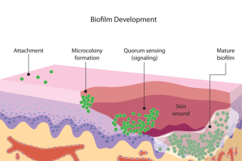 biofilm development stages